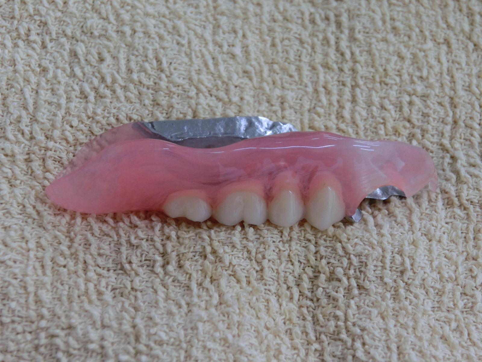 コンビネーションデンチャー-6