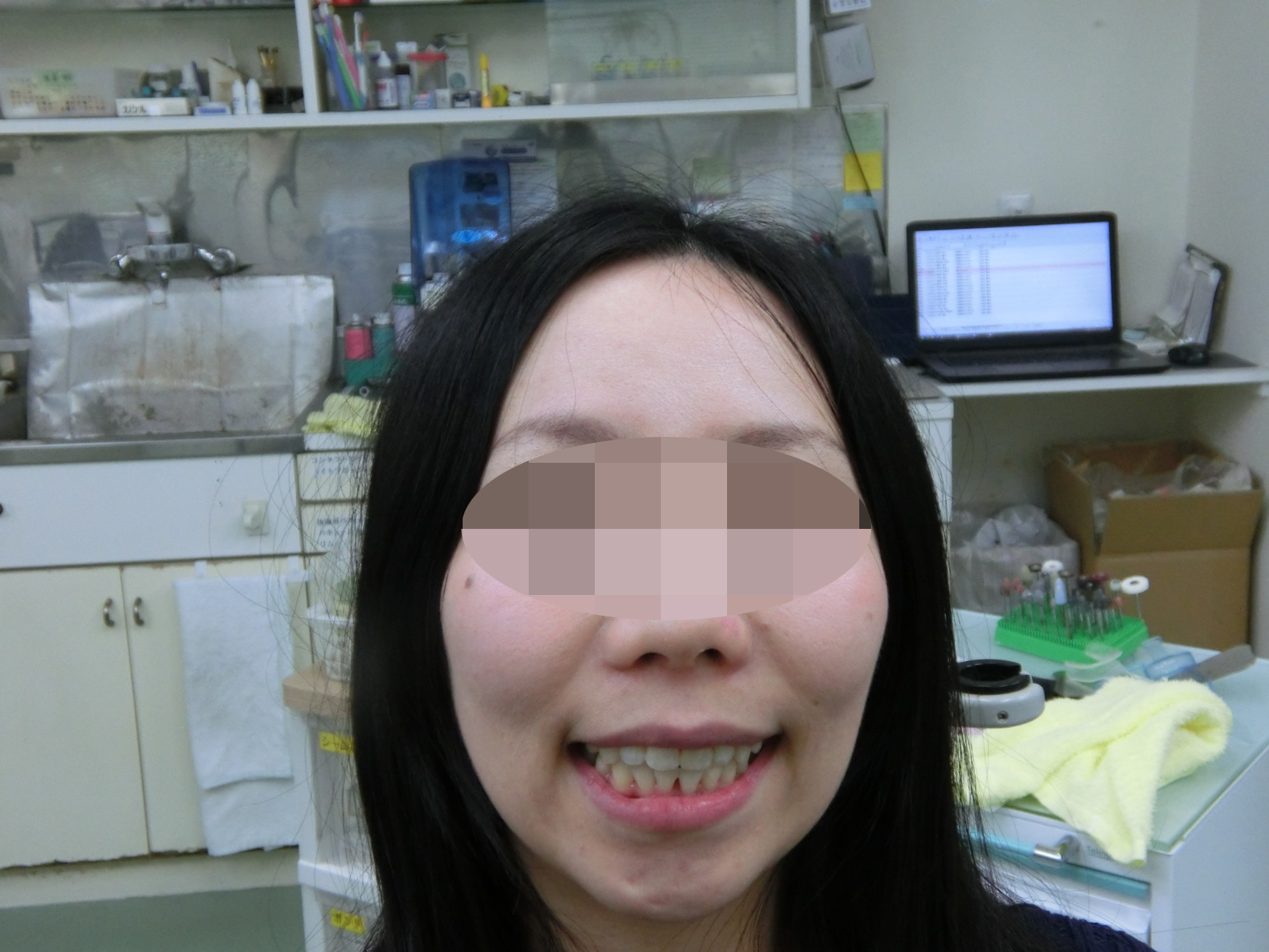 術後正面観